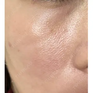 メディカルエピレーションクリニック メディカルエピレーションクリニック 心斎橋院口コミ