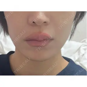 TCB東京中央美容外科 TCB東京中央美容外科 新宿東口院口コミ