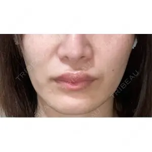 ビラビューティークリニック 博多美容外科/美容皮膚科 ビラビューティークリニック口コミ