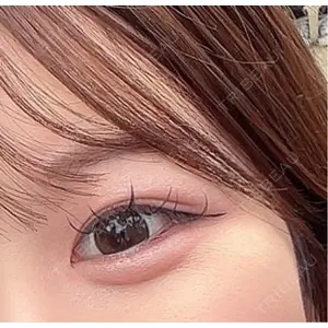 アネシス美容クリニック口コミ