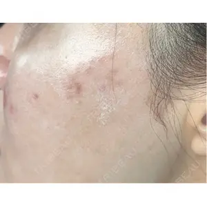 APスキンクリニック銀座口コミ