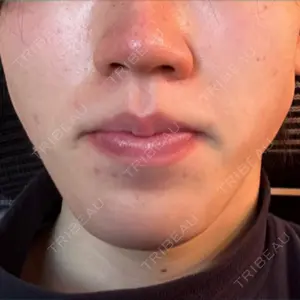 APスキンクリニック銀座の