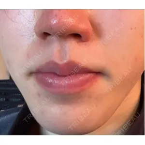 APスキンクリニック銀座の