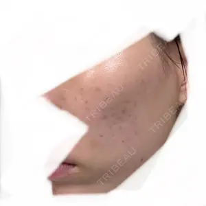 東京シルククリニック 東京シルククリニック 新宿院口コミ