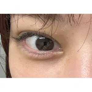 口コミ