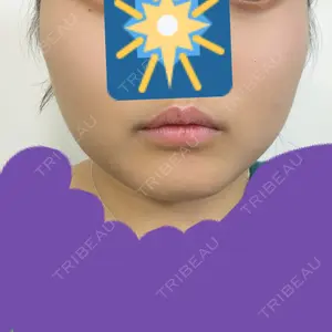 TCB東京中央美容外科 TCB東京中央美容外科 新潟院口コミ