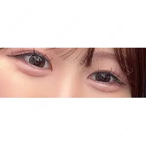 アネシス美容クリニック口コミ