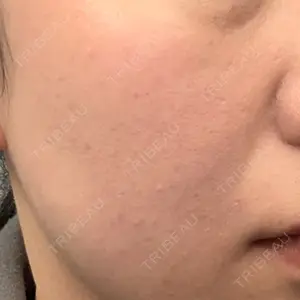 ルラ美容クリニック ルラ美容クリニック 仙台院 / ルラスキンクリニック 仙台院口コミ