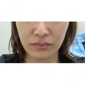 ビラビューティークリニック 博多美容外科/美容皮膚科 ビラビューティークリニック口コミ