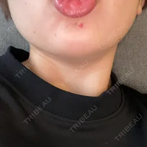 口コミ