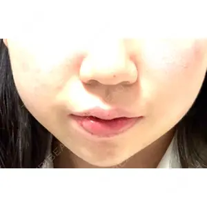 ルラ美容クリニック ルラ美容クリニック 大阪本院口コミ