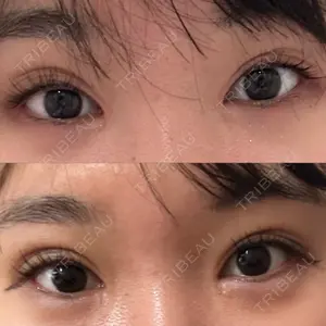 Nebula Clinic ネビュラクリニック 東京錦糸町院口コミ