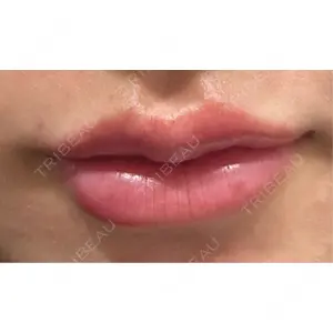 口コミ
