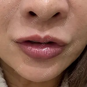 APスキンクリニック銀座口コミ