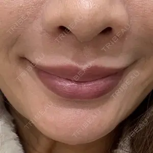 APスキンクリニック銀座口コミ