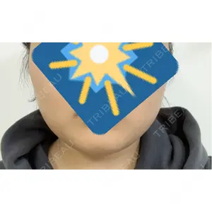 TCB東京中央美容外科 TCB東京中央美容外科 新潟院口コミ