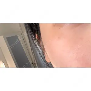 PureMe Skin Clinic（ピュアミースキンクリニック麻布）口コミ