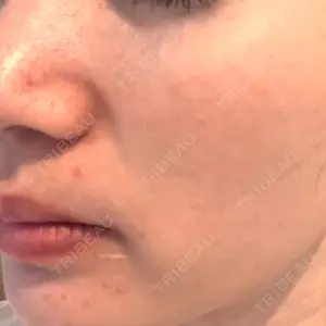 Chloe Cheongdam Clinic （クロエチョンダムクリニック）口コミ