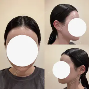 plume clinic plume clinic口コミ