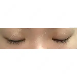 アイビークリニック 吉祥寺アイビークリニック口コミ