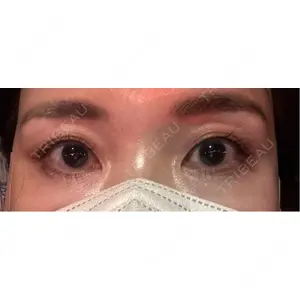 APスキンクリニック銀座口コミ