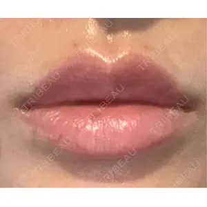 APスキンクリニック銀座口コミ