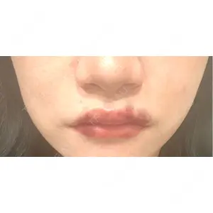 アイビークリニック 千葉美容外科アイビークリニック口コミ