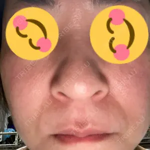 メディカルエピレーションクリニック メディカルエピレーションクリニック 心斎橋院口コミ