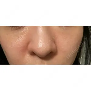 ヴェリテクリニック ヴェリテクリニック 銀座院口コミ