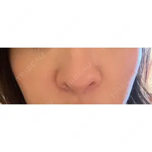 ヴェリテクリニック ヴェリテクリニック 銀座院口コミ