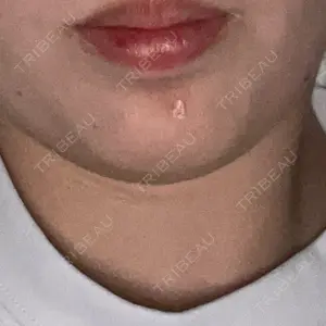 口コミ