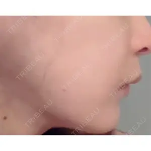 BLINC CLINIC （ブリンク クリニック）口コミ