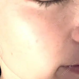 Chloe Cheongdam Clinic （クロエチョンダムクリニック）口コミ