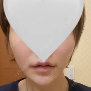 BLINC CLINIC （ブリンク クリニック）口コミ