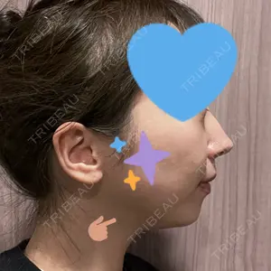 HINATA クリニック口コミ