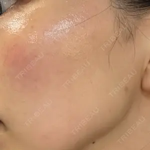 AURORA CLINIC（オーロラクリニック）新宿院口コミ