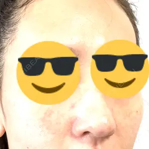 日本美容・医療クリニック 日本美容・医療クリニック 六本木院口コミ