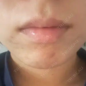 ルラ美容クリニック ルラ美容クリニック 福岡本院口コミ