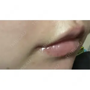 口コミ