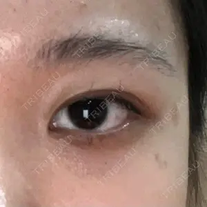 HAAB×DREAM BEAUTY CLINIC HAAB BEAUTY CLINIC 名古屋院口コミ