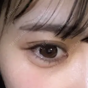 アリエル美容クリニック アリエル美容クリニック 水戸院口コミ