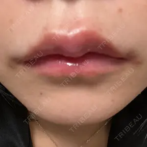 アリエル美容クリニック アリエル美容クリニック 水戸院口コミ