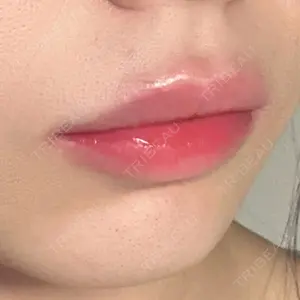 フィラークリニック フィラークリニック 大阪心斎橋院口コミ