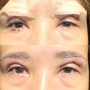 銀座リシェスクリニック口コミ