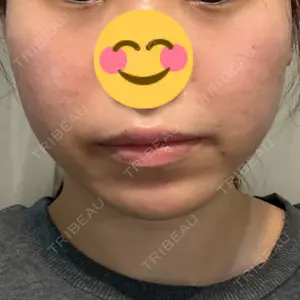 おおたかの森ビューティークリニック おおたかの森ビューティークリニック口コミ