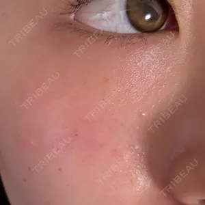 TCB東京中央美容外科 TCB東京中央美容外科 名古屋栄院口コミ