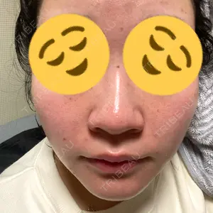 アクティブエイジクリニック アクティブエイジクリニック口コミ