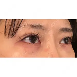 Nebula Clinic ネビュラクリニック 東京錦糸町院口コミ