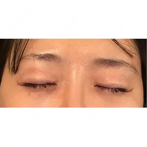 Nebula Clinic ネビュラクリニック 東京錦糸町院口コミ