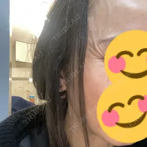 東京シルククリニック 東京シルククリニック 新宿院口コミ